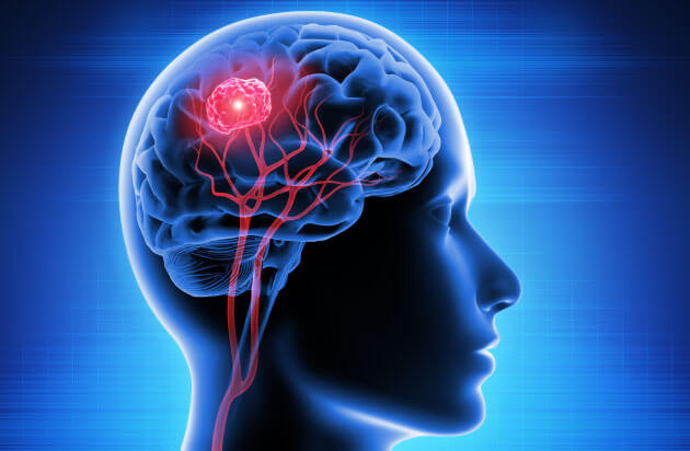 Neurology & Brain Surgery
